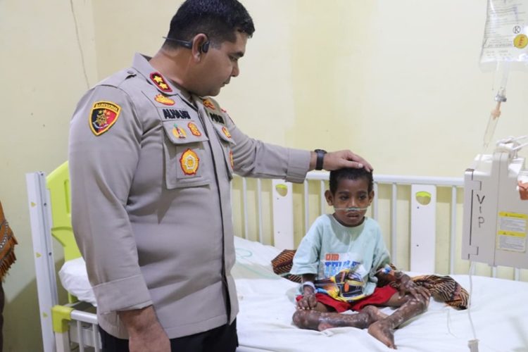 Kapolres SBT AKBP Alhajat saat melihat keadaan KS di Rumah sakit